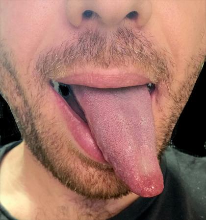 הגדל תמונה של yored