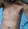 Adamcoll