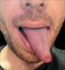 אלבום של yored